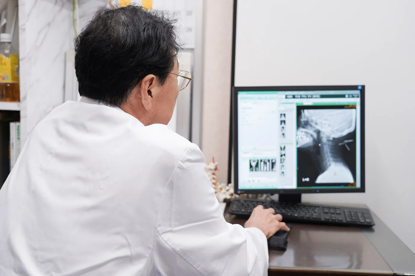 医師がレントゲン画像を確認する様子